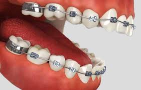 Ortodonti 1